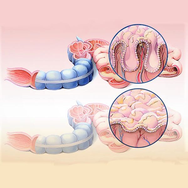 Ilustración intestino